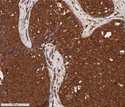 Cytokeratin 1 Antibody (LHK1) - Azide and BSA Free, Novus Biologicals 0.1